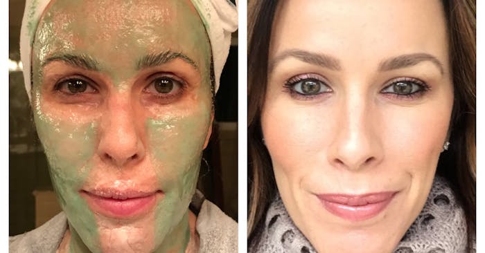 Enzyme facial before and after photo